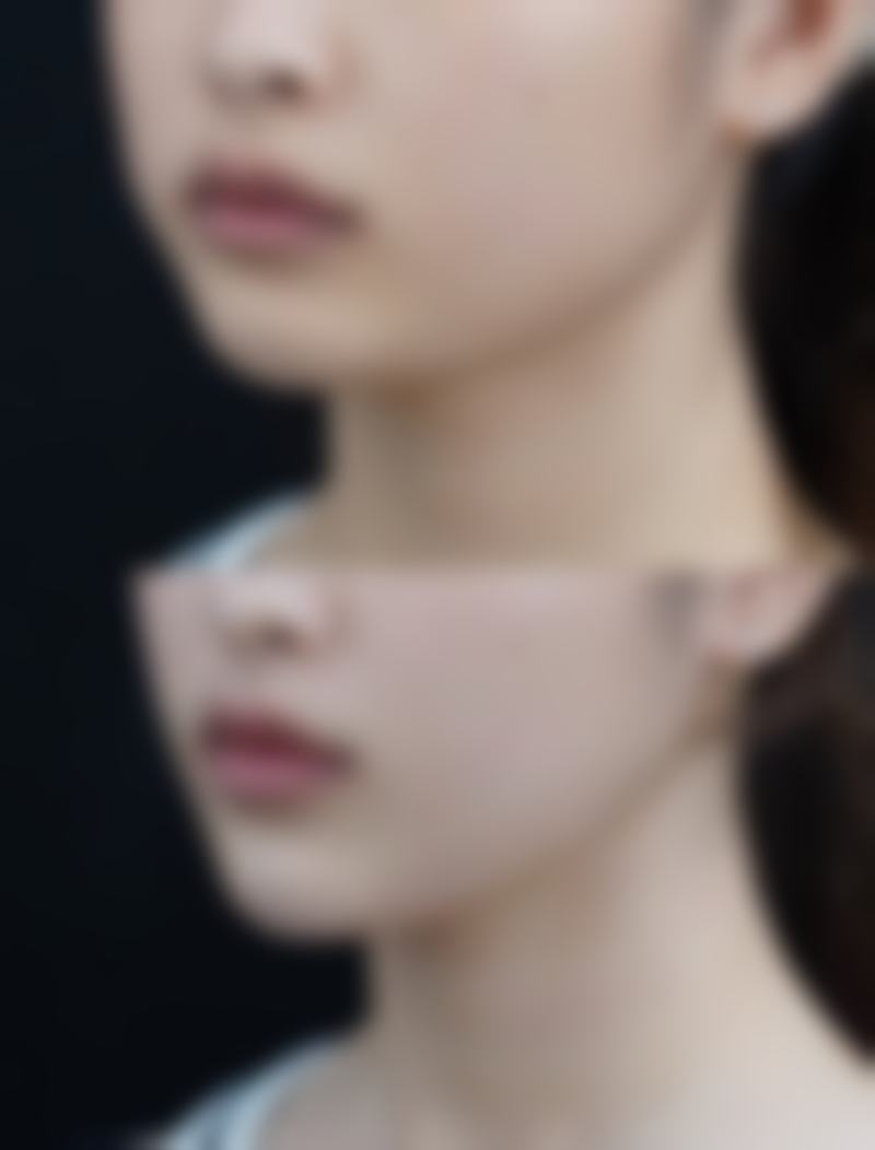 罗荣新医生 覆盖全方面的擅长医美项目