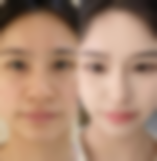 济南历城未来医疗美容诊所求美者反馈