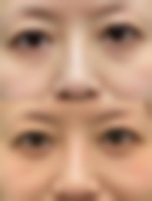 杭州悦俐整形医院求美者反馈