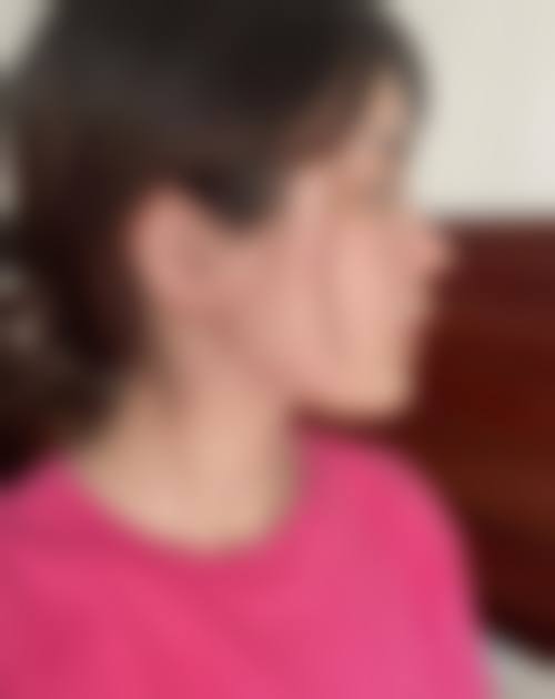 深圳呈悦整形医院价格收费