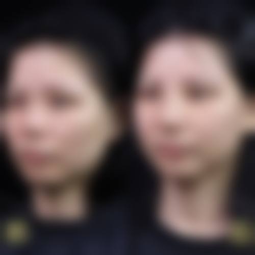 深圳呈悦整形医院求美者反馈