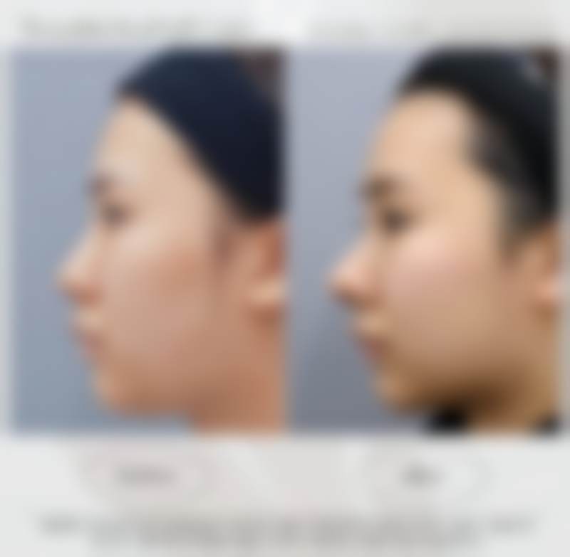 朴哲佑医生擅长的全品类整形项目