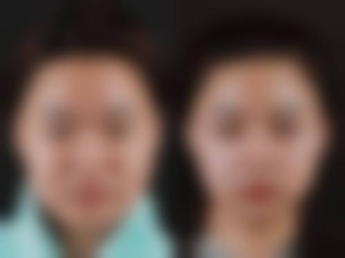 韩国诺宝丝整形外科医院求美者反馈