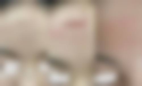 重庆弗洛医疗美容特色项目及技术优势