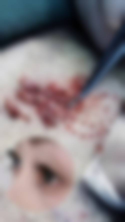 温州芬迪医美价格收费