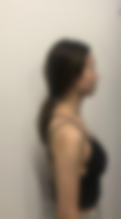 韩国妩婯整形医院求美者反馈