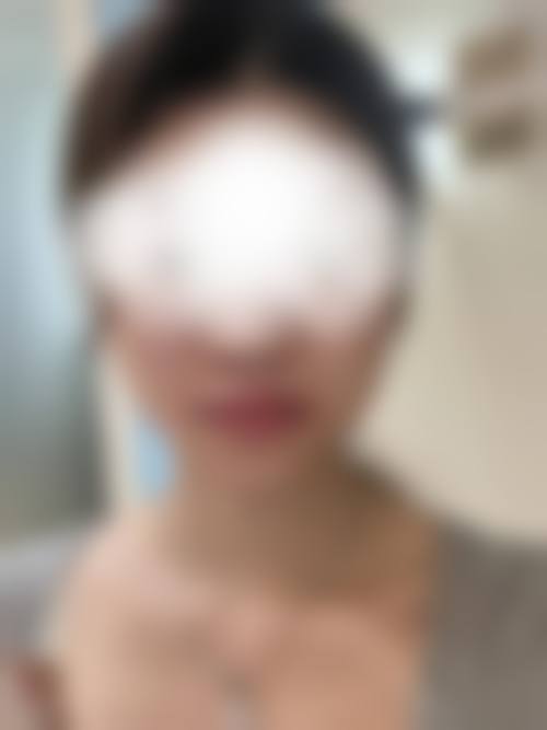 韩国妩婯整形医院价格收费