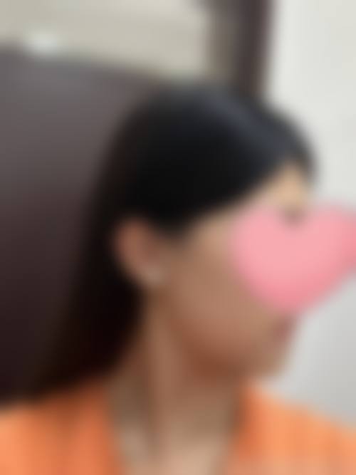 温州芬迪医美来院路线