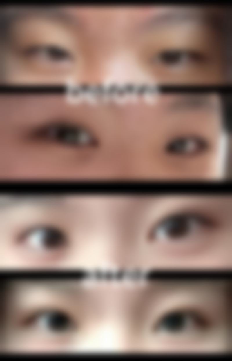 朔州华美张鹏整形医院求美者反馈