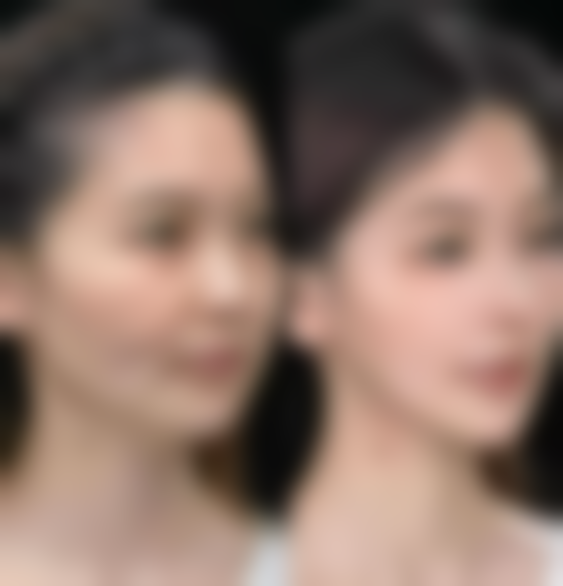 朔州华美张鹏整形医院特色项目及技术优势