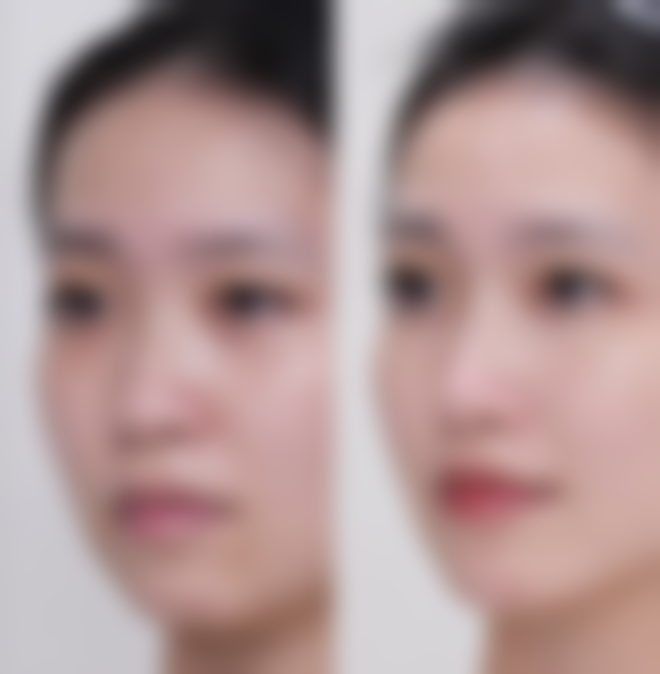 朔州华美张鹏整形医院价格收费