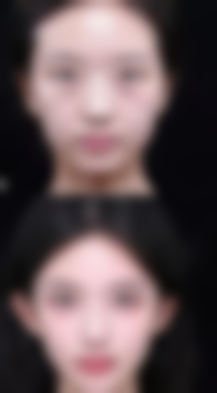 温州芬迪医美求美者反馈