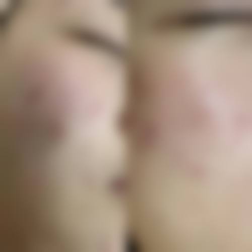 衢州乔安奕美整形医院特色项目及技术优势