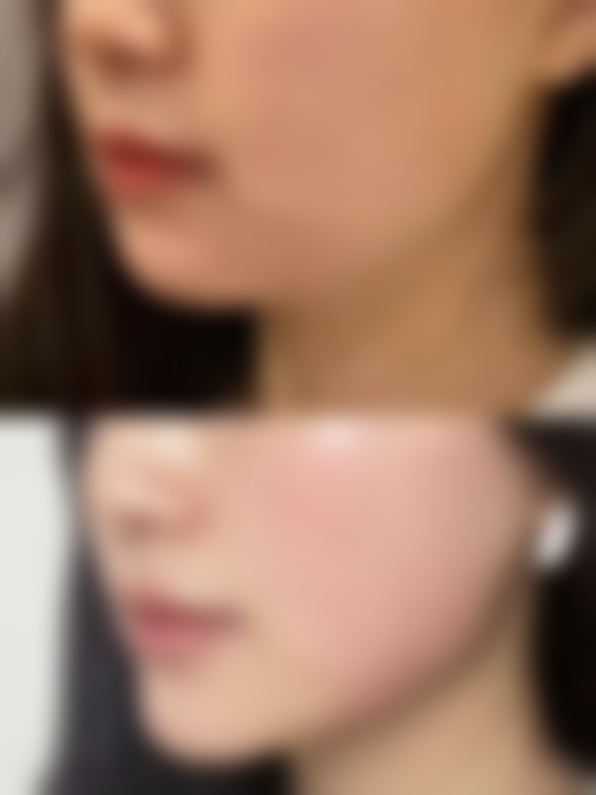 韩国INFINI整形外科的专精诊疗保护