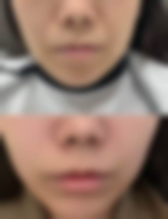 便捷预约杨子医生面诊的渠道指引