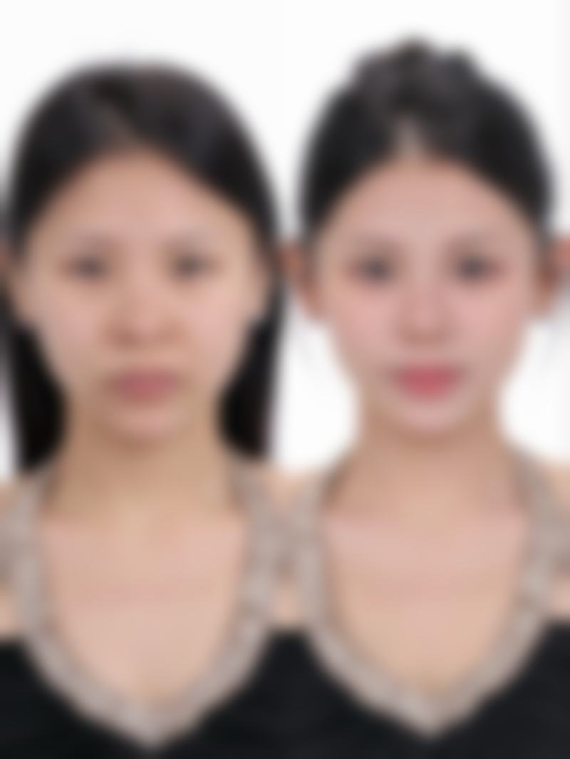 韩国TN皮肤科价格收费