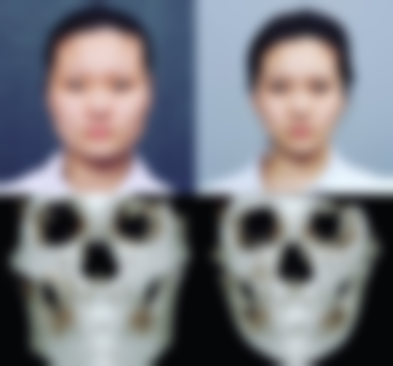 韩国TN皮肤科求美者反馈