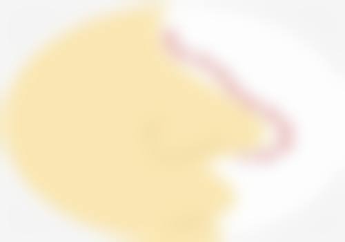 韩国Banana整形外科求美者反馈