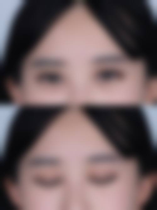 缇美思医美求美者反馈