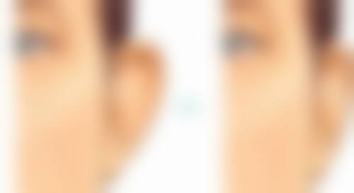 晋江耀美医疗美容医院特色项目及技术优势