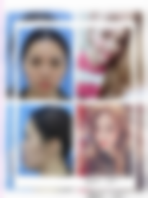 郭新雯医生覆盖全品类医美项目,满足多元变得更美需求