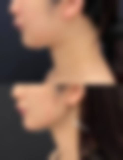 哈尔滨悦美芳华医疗美容门诊部求美者反馈