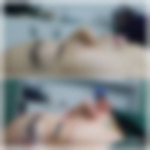 郑州华肤皮肤病医院价格收费