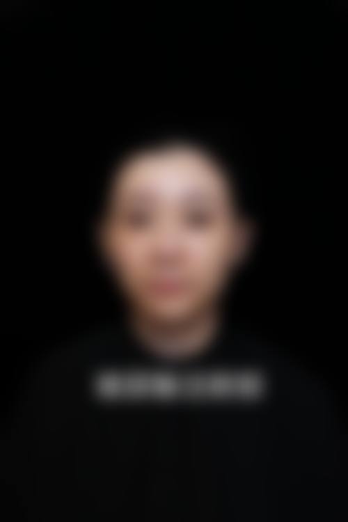 黎护忠医师的个性化医美服务原则