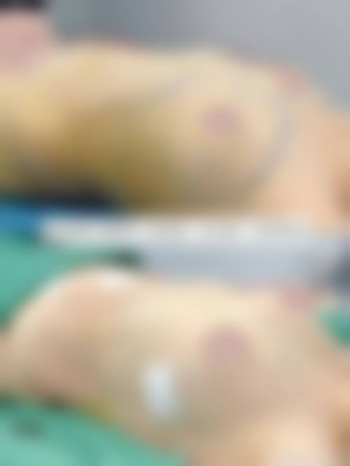 广州韩秀医疗美容门诊部求美者反馈