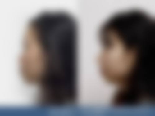 广州如花医疗美容整形医院求美者反馈