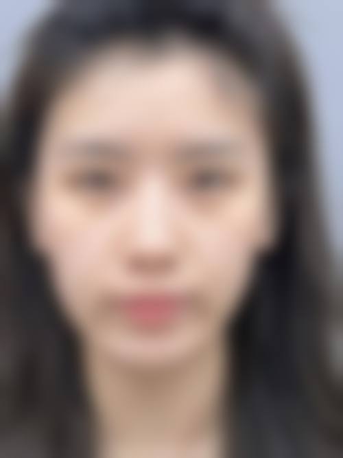 海口伊美汇医疗美容诊所求美者反馈