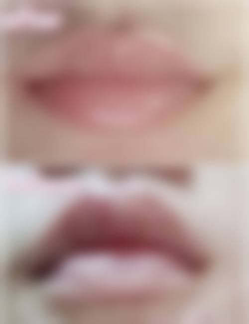 西宁韩海俊医疗美容诊所价格收费