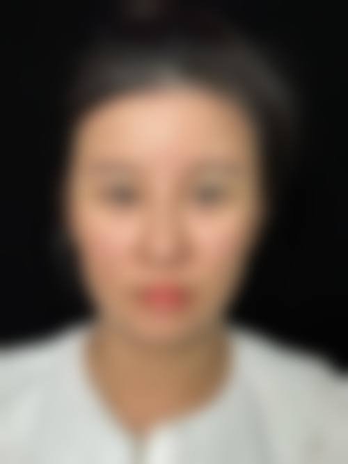 深圳明莱医疗美容诊所求美者反馈