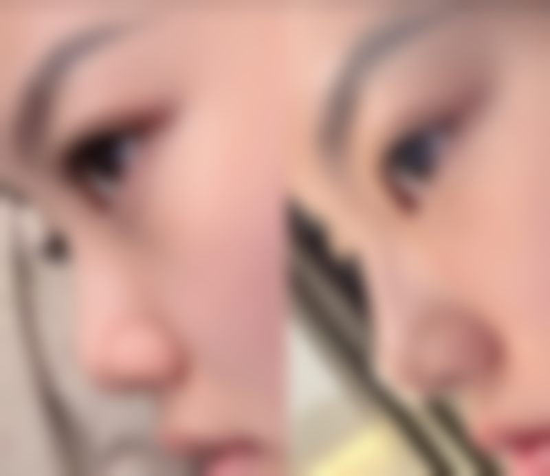 杭州芭莎丽人医疗美容门诊部特色项目及技术优势