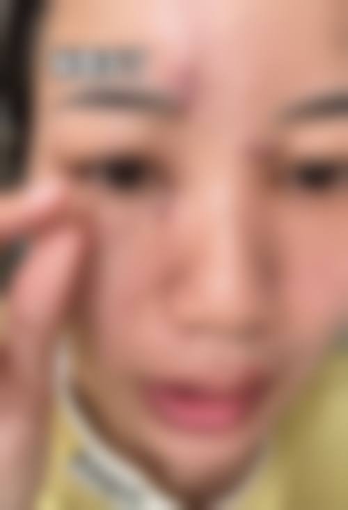 武汉欣美颜医疗美容机构求美者反馈