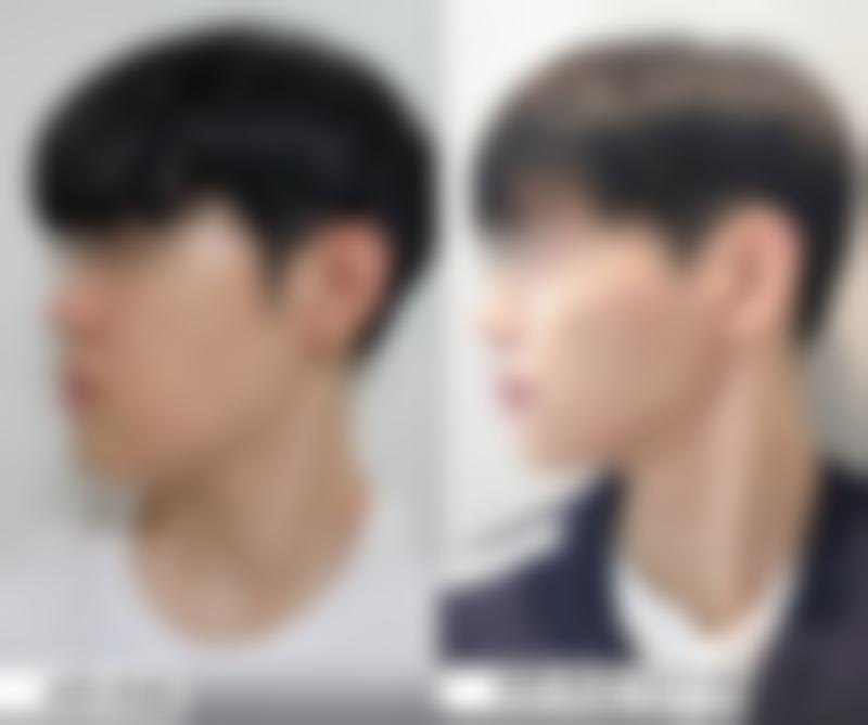 透明化收费标准