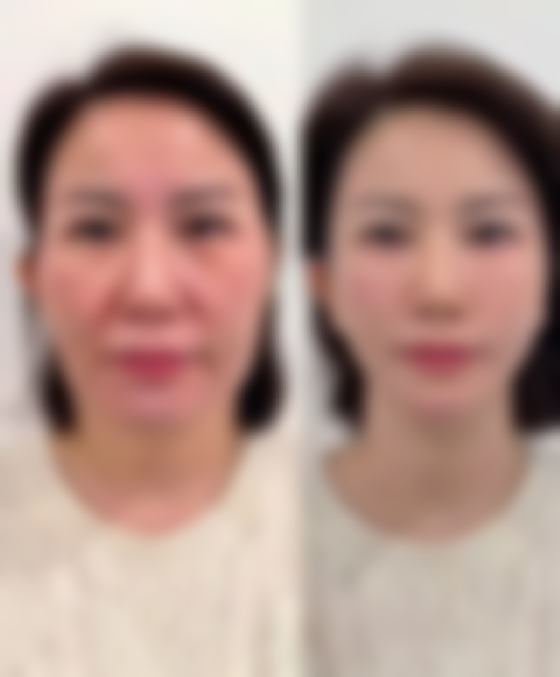 哈尔滨美意整形医院来院路线