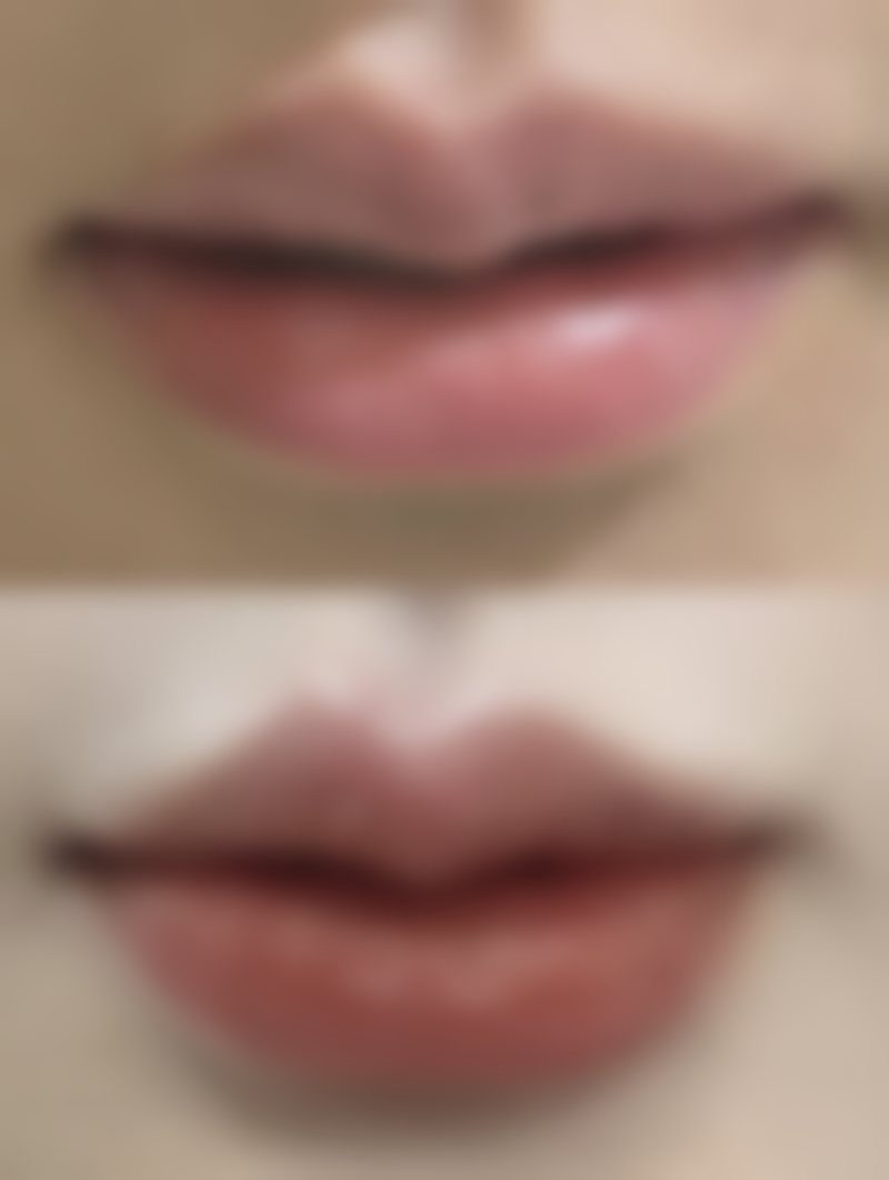 求美者真实反馈