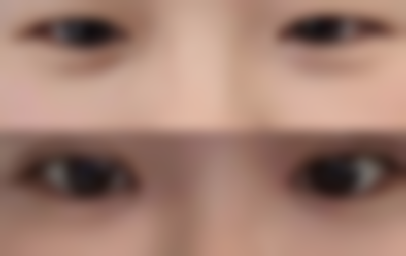 预约李在承院长的专属方式