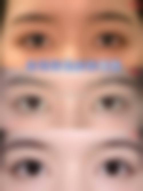 求美者真实反馈