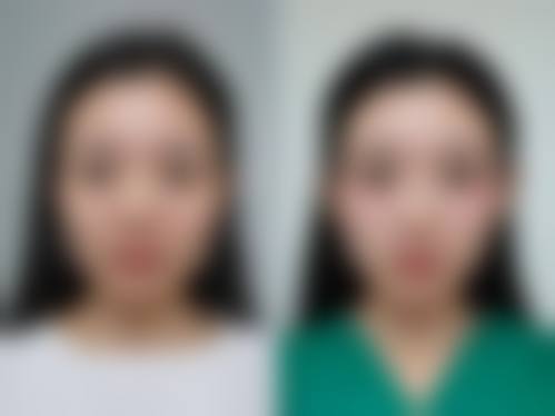 求美者真实体验反馈