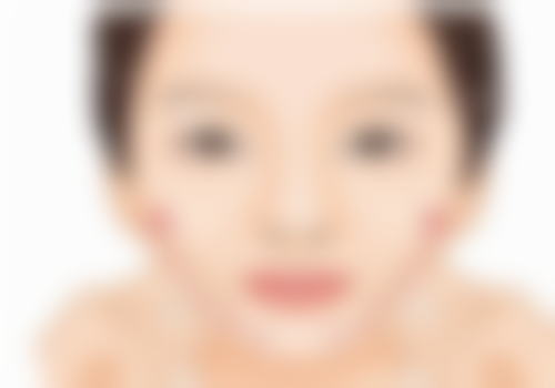 求美者真实反馈