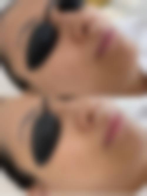 求美者真实反馈