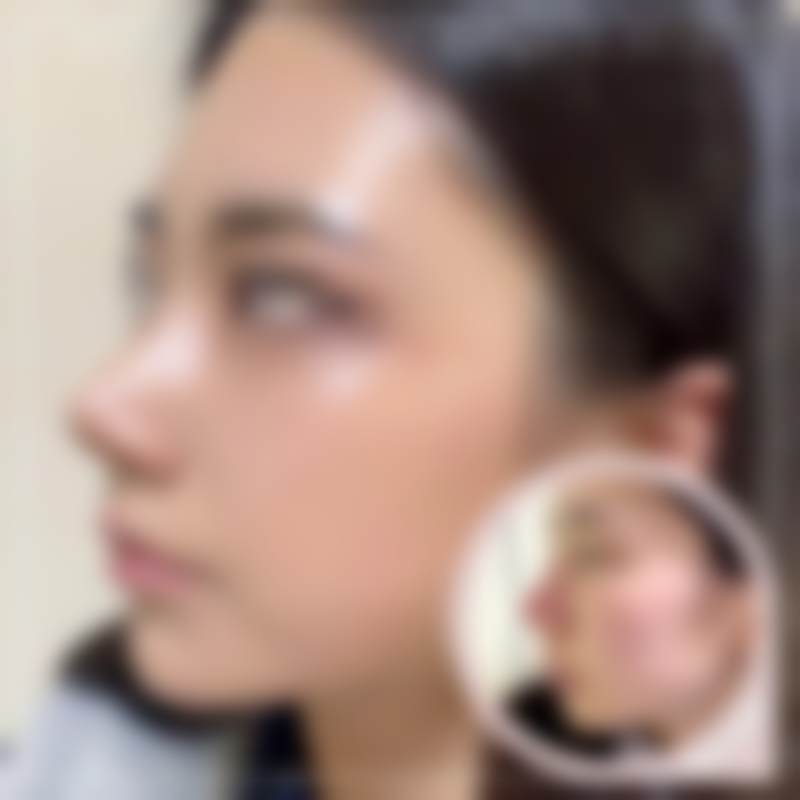 朴哲佑院长擅长的全品类医美项目与特色诊疗