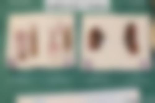 求美者真实反馈