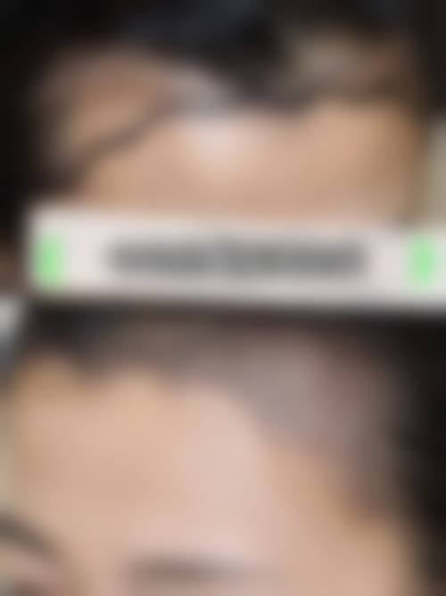 刘诚医生坚持的专精医美准则