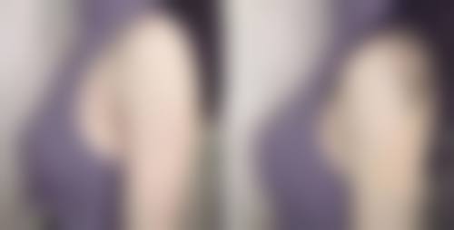 谢中奎可开展胸部塑形与吸脂体态调整项目