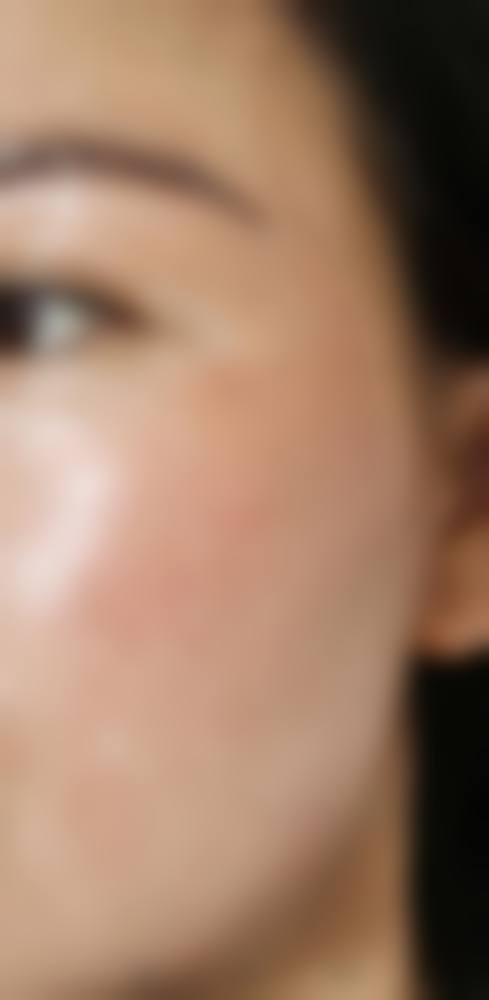 李明钟院长的个性化医美诊疗理念