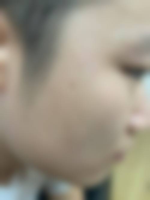 周李燕医师的合规医美服务保护