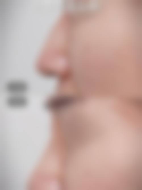 到院服务与预约